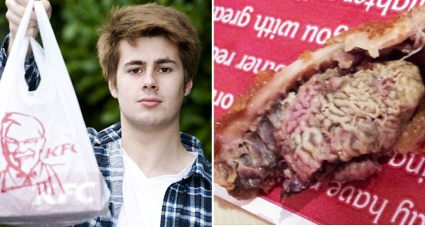 KFC, Ayam Gorengnya Berisi Otak... Hiiiiii....